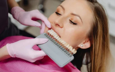 Composite Bonding vs Veneers: Which Is Right for Your Smile?