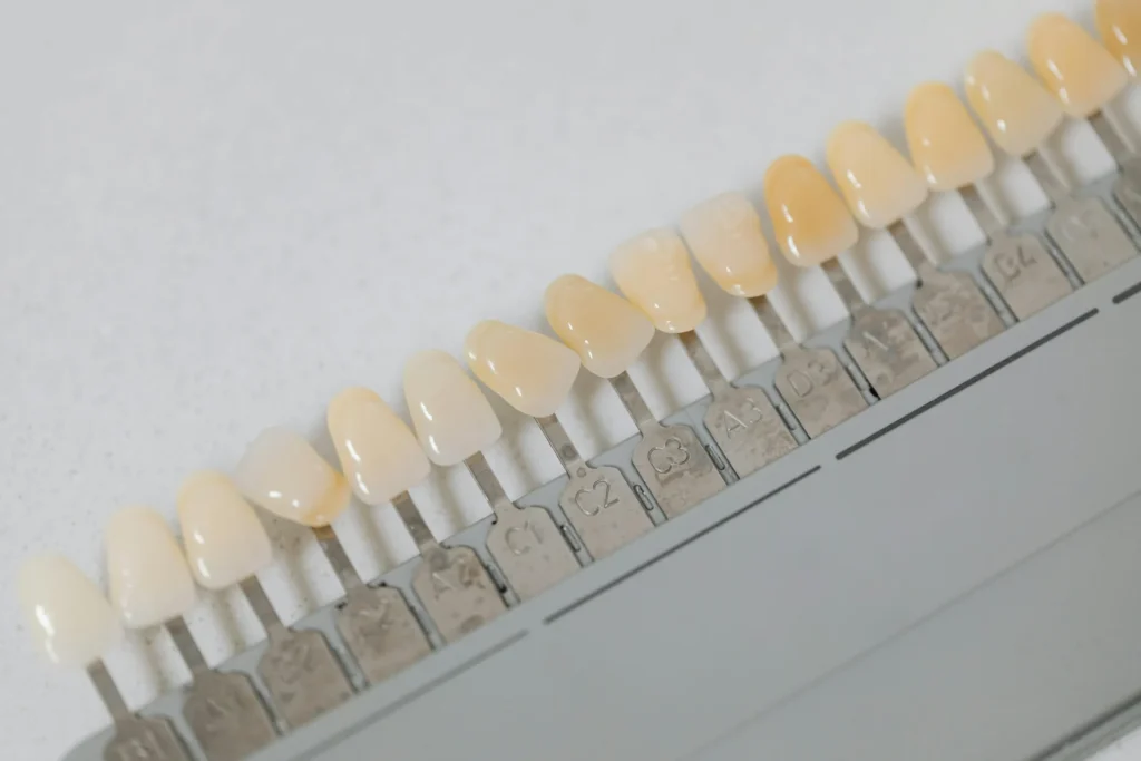 Dental shade guide used for veneer and bonding treatment planning.