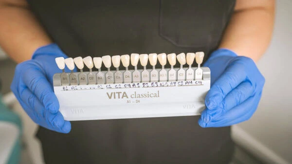 teeth whitening shade chart