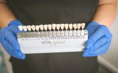 What Stains the Teeth Most After Whitening?