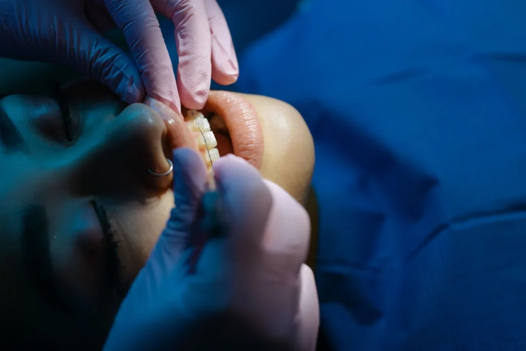 Dental professional adjusting fixed braces during an adult orthodontic appointment.