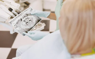 What is a dental bone graft and when is it needed?